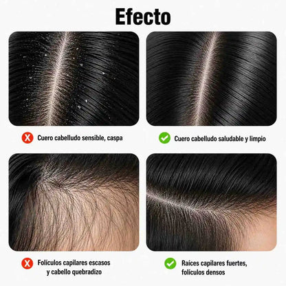 Masajeador de Cuero Cabelludo - Relajación y Estímulo Capilar